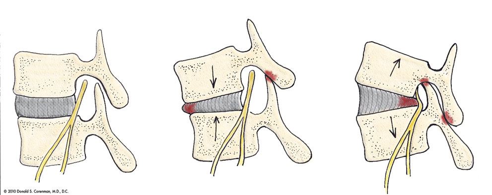 Anatomy of the Lumbar Spine | Spine Anatomy | Colorado